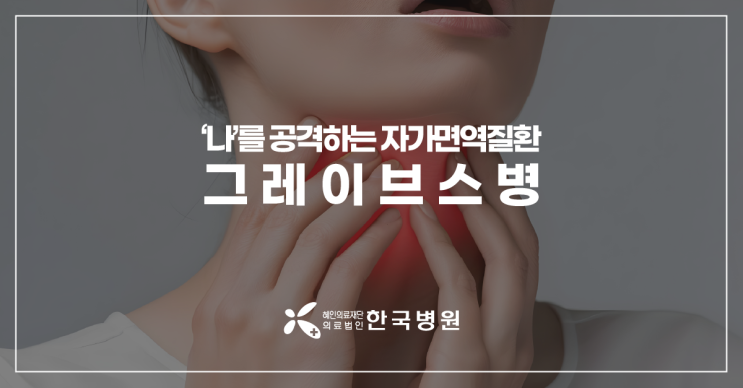  제주 내분비대사내과_눈이 튀어나온다? 갑상선의 반란, 그레이브스 병