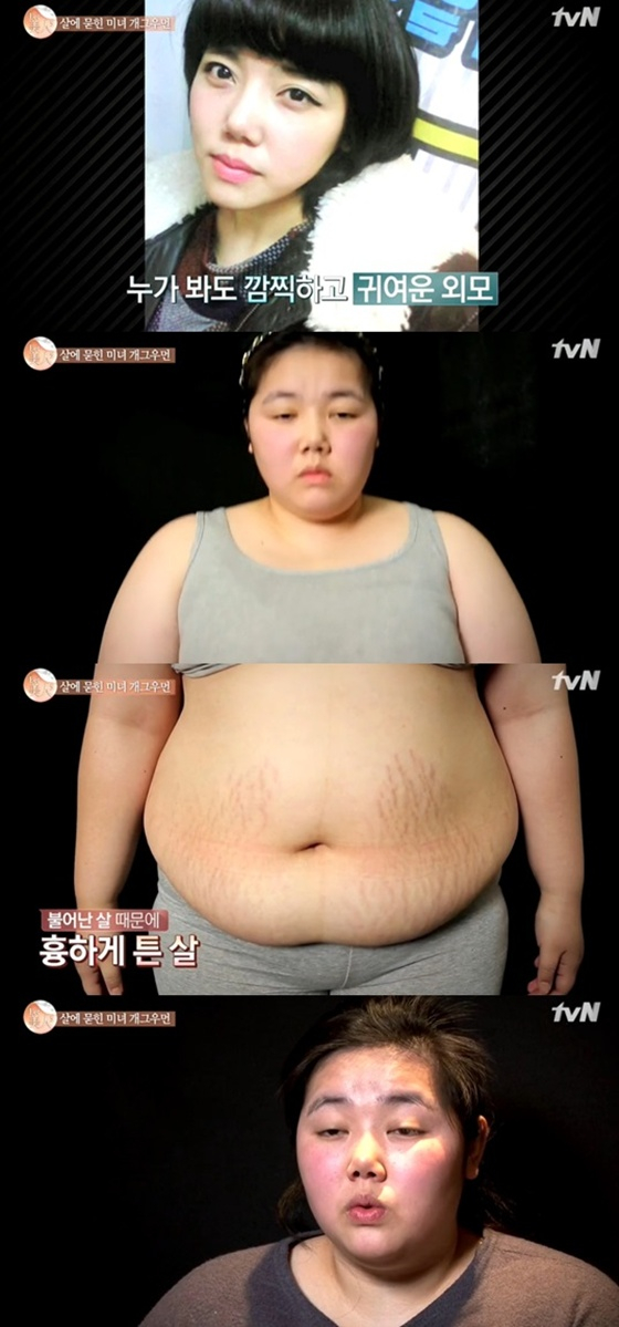  “‘렛미인’ 34kg 감량한 ‘미녀 개그우먼’의 뜻밖 근황…체중 127kg에 ‘먹토’하며 먹방까지?”