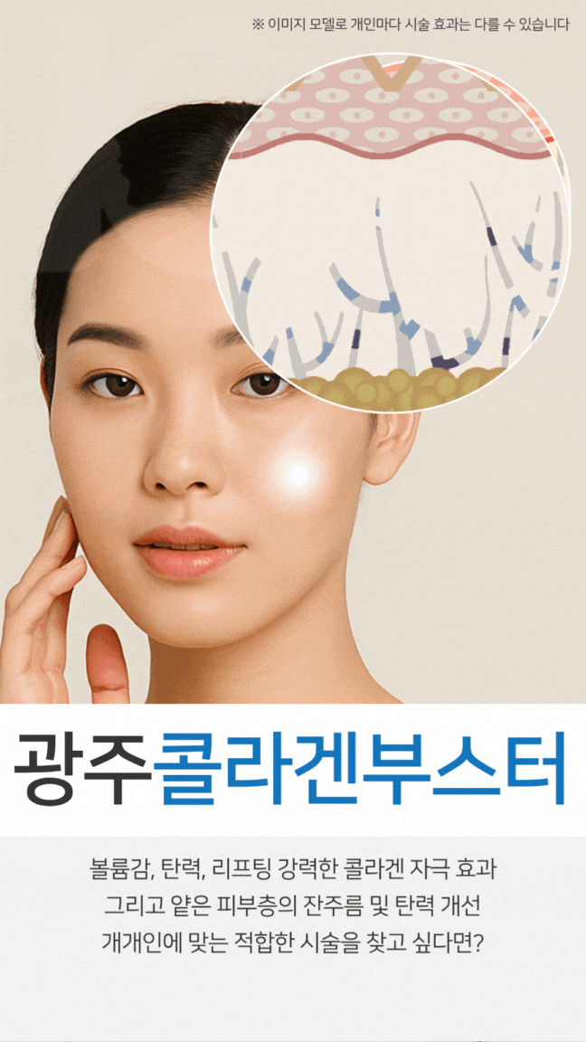  광주다크서클 고민이라면 눈밑을 채우는 콜라겐부스터 알아볼까