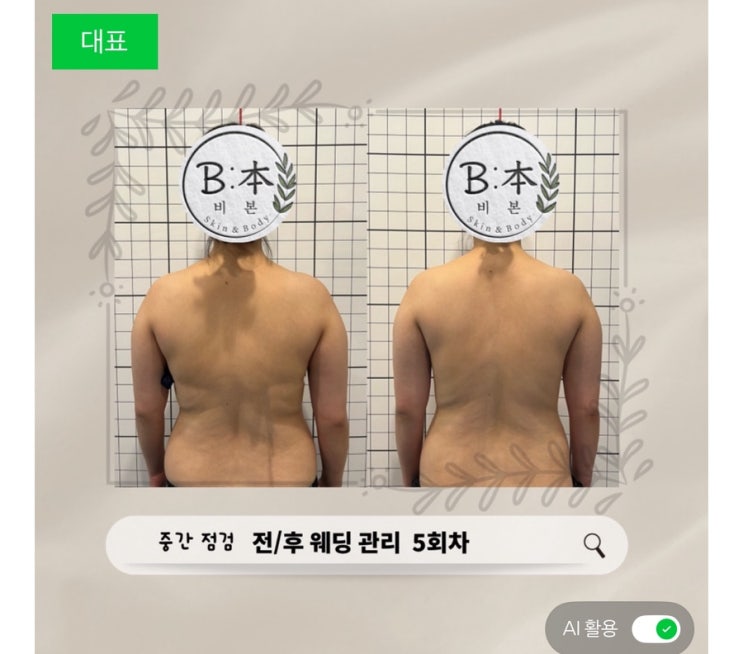  부산 예비신부를 위한 웨딩 바디관리