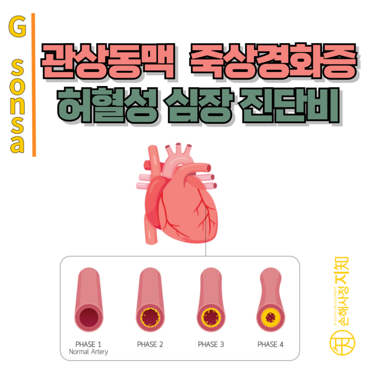  관상동맥 죽상경화증, 협심증 보험금 거절? 허혈성심장질환 제대로 받으려면 - [보험금, BA+DA]