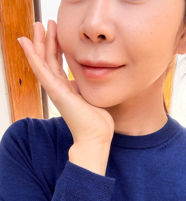  홍대피부과 안아픈 리쥬란효과  내돈내산 일주일 차 솔직후기