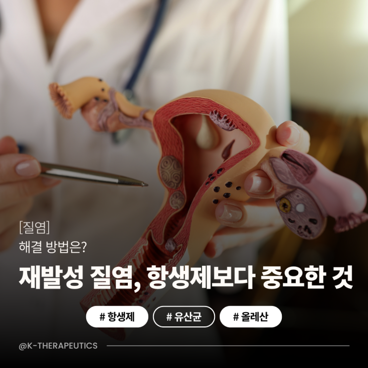  [질염] 재발성 질염! 항생제보다 ‘이것’이 중요!