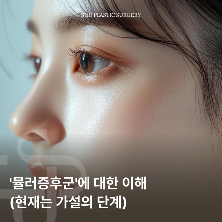  눈매 교정과 '뮬러증후군'