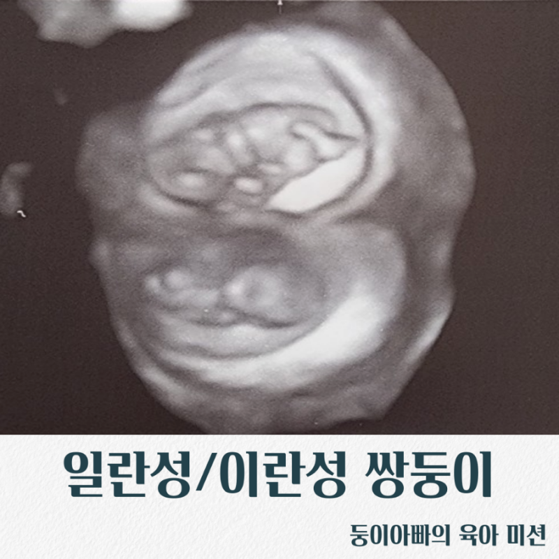 [육아정보/쌍둥이확률]일란성/이란성쌍둥이확률/쌍둥이생기는이유/쌍둥이임신주의사항/쌍....