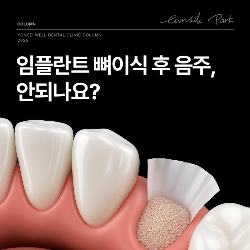 뼈이식임플란트 후 음주 5일 가능한가요?