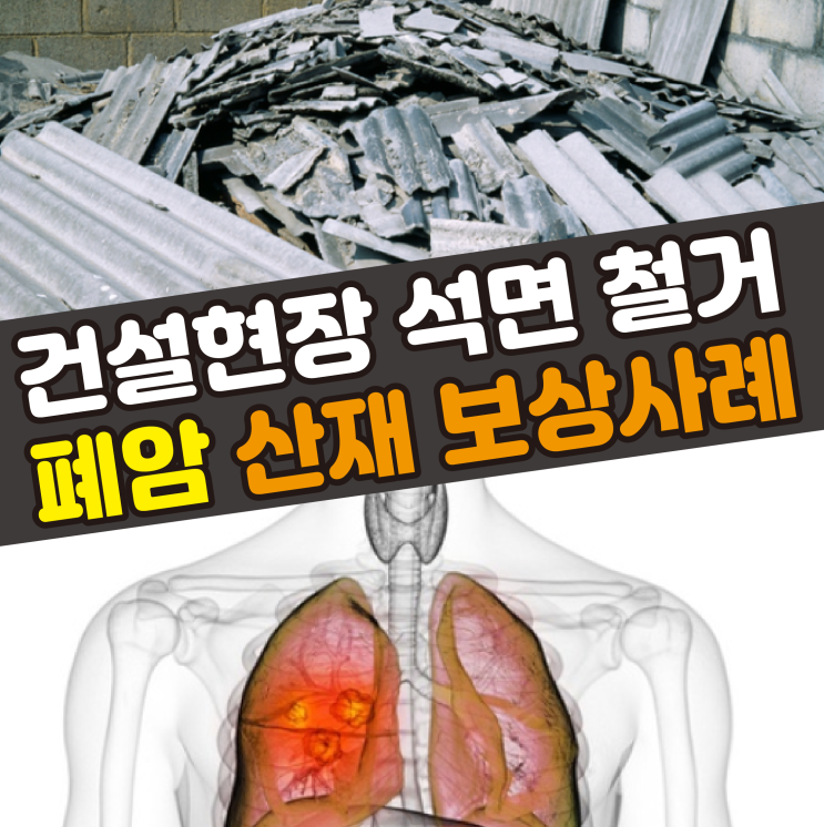 [부산/문경/대구 노무사] 건설현장 석면 철거 폐암 산재 신청 보상사례