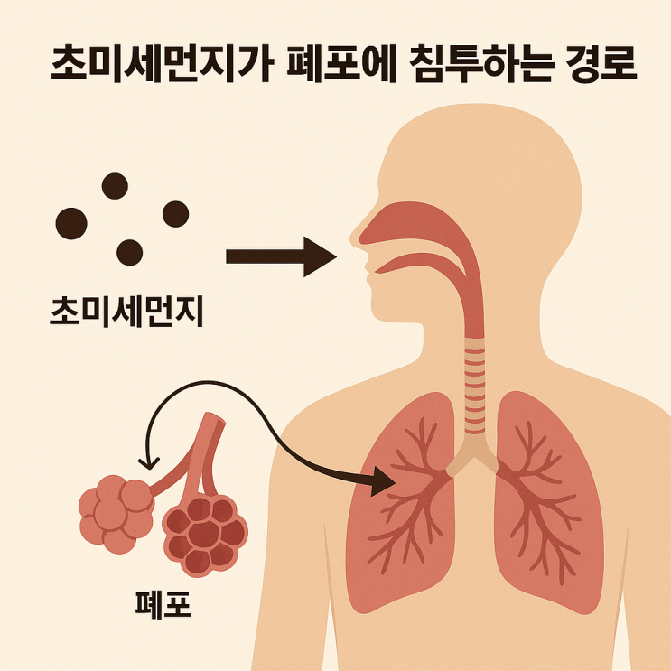  더위가 폐 건강을 위협한다 – 초여름 호흡기 관리법 완전 정리