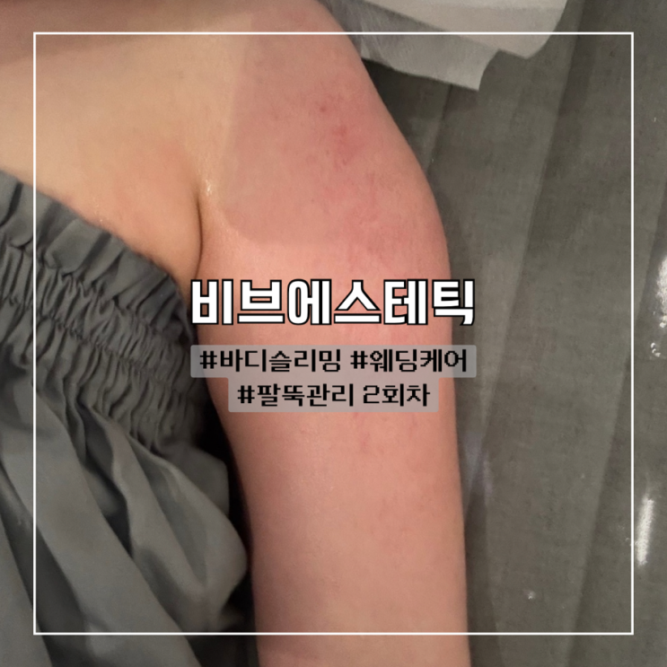 광주 상무지구 신부관리 팔뚝관리 2회차 후기 :: 비브에스테틱