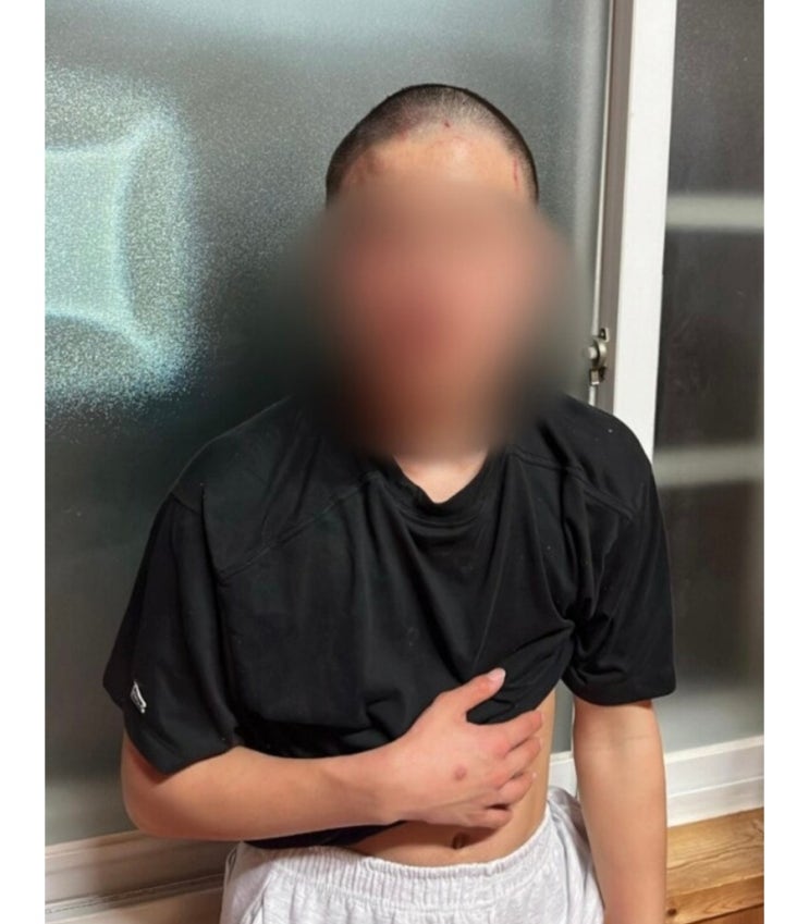   [충격] 충남 청양 고등학생 집단 학교폭력…4년간 지옥 같았던 삶