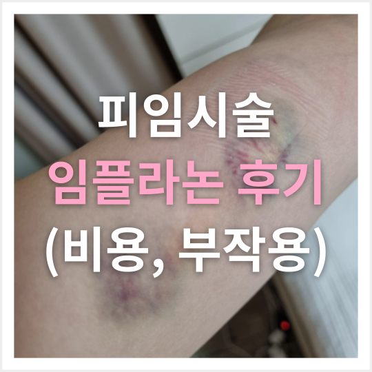 [찐후기] 임플라논 시술 & 3년 안 채우고 제거 후기 (가격, 부작용, 제거 이유, 시술과정)