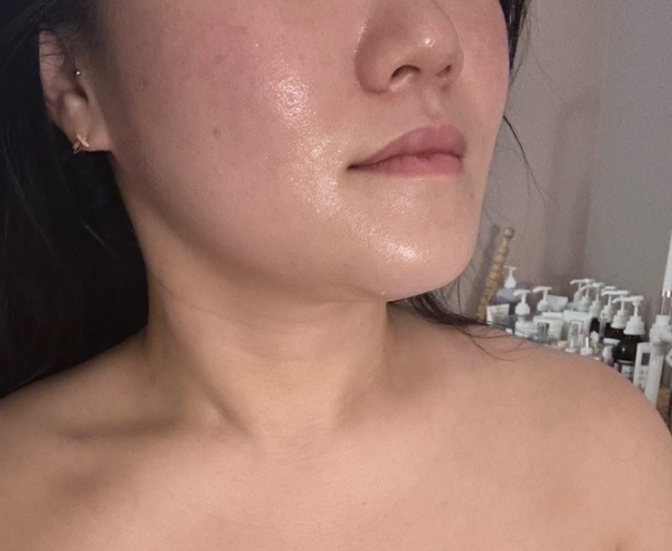 문정동피부관리 턱선이 달라졌어요 : 린에스테틱 문정점