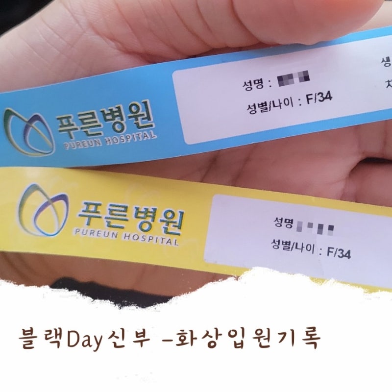 대구 푸른병원 입원 비용, 화상 가피절제술 후기 입니다.