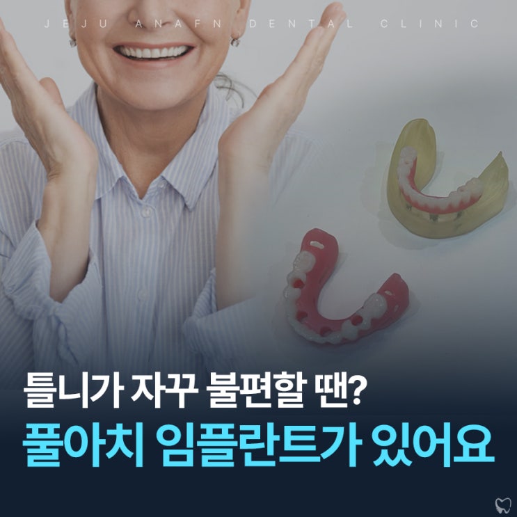  제주시치과 틀니가 불편할 때 풀아치 임플란트 어떠세요