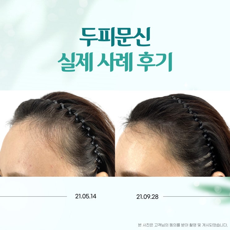  합정두피문신 가장 많이 묻는 질문 FAQ (가격, 술, 유지기간, 후기)