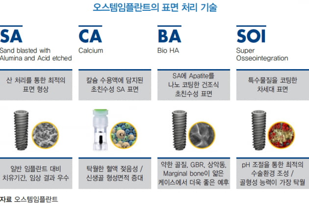  "바른약속치과에서 사용하는 임플란트 기술, 포인트UV·BA·SOI 차이 한눈에!"