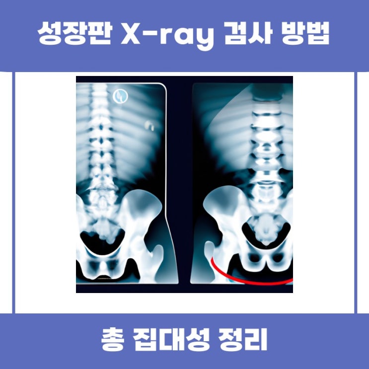  성장판 Xray 검사 방법 쉽게 알아볼까요