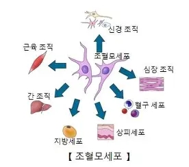 조혈모세포 이식(Stem cell transplantation)이란