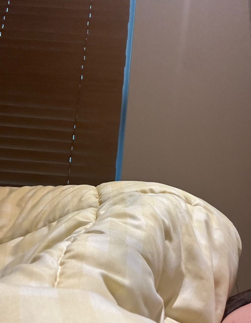 여성 곤지름(콘딜로마) 인유두종바이러스 치료 후기 (HPV, STD 검사, 질확대경검사, 넓은 부위 ....