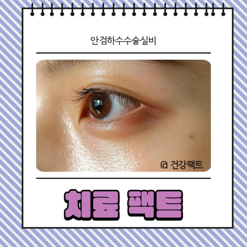 안검하수수술실비 비용 보험 적용 기준 총정리!