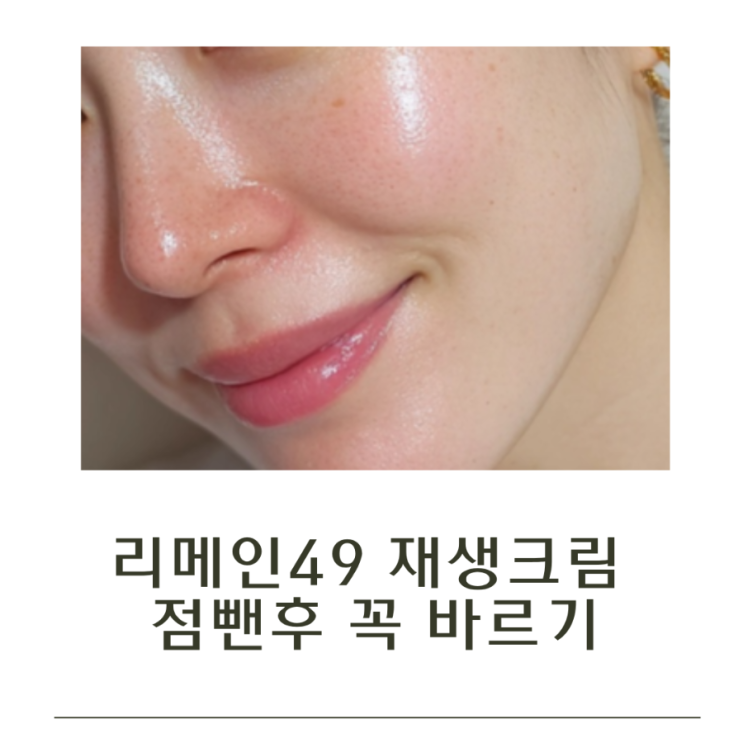  리메인49 재생크림 점뺀후 꼭 바르기