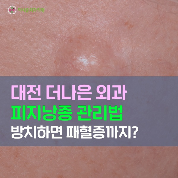 피지낭종 오래 방치하면 패혈증까지 정확한 관리법은?