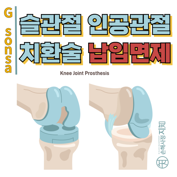  양쪽 무릎 인공관절 수술 보험료 납입면제, 소비자는 어떻게 이겼나? - [조정례, BoDa]