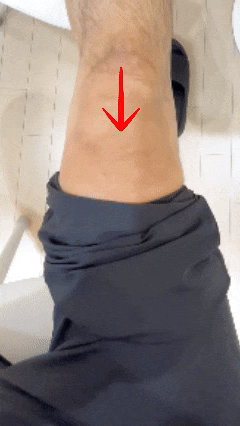  대퇴사두근: 너를 알아보자