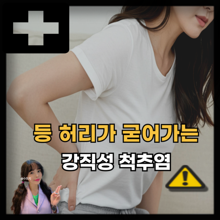  강직성 척추염 증상 통증 진단 검사 치료 알아보기
