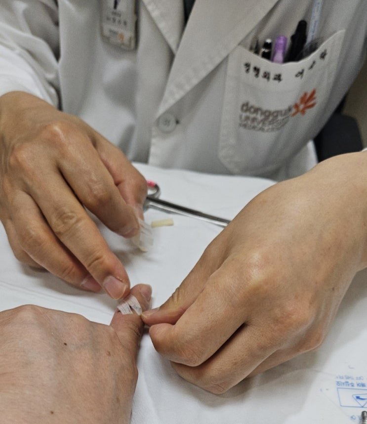 동국대학교일산병원 명의 어수락 성형외과 거대세포종 증상 치료 수술 친절 자상 100점 의사선생님