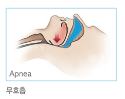  수면 입마개, 무호흡 있다면 쓰지마세요