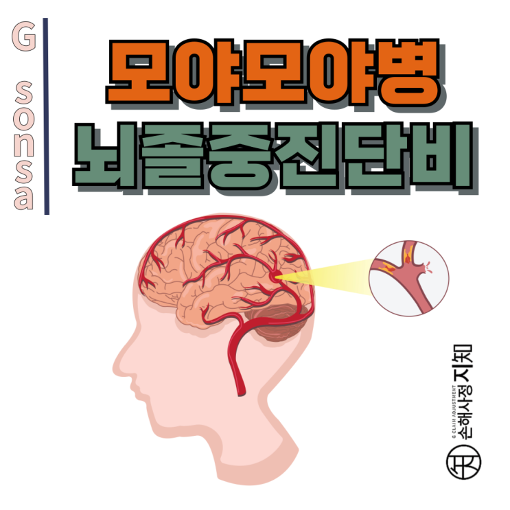  모야모야병 뜻 - 협착 소견 있어도 진단비 거절? 해결 사례 알려드려요 - [보험금, BA+DA]