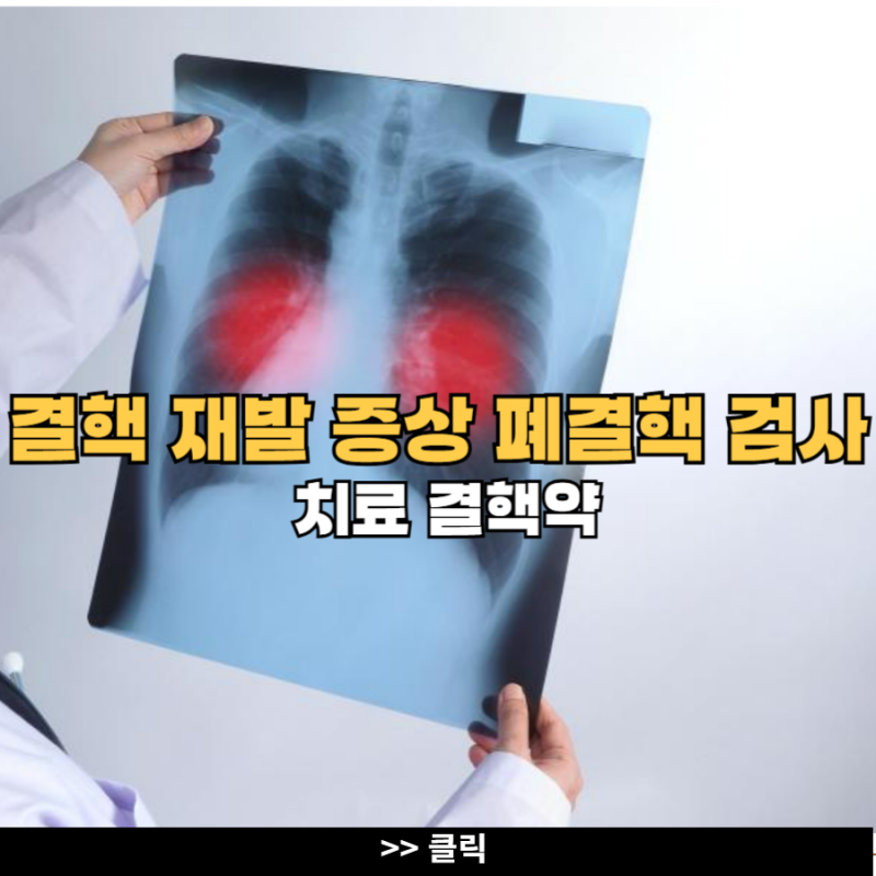 결핵 재발 증상 폐결핵 검사 치료 결핵약 : 네이버 블로그
