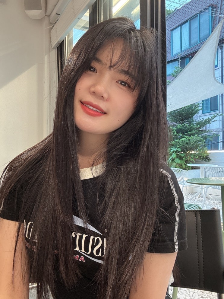  강남역치과 내돈내산 제로네이트 시술 후기! 무삭제라미네이트 비용,단점,부작용