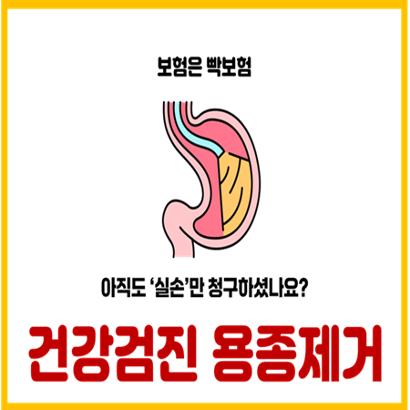  건강검진시 대장 위 용종 제거 후 수술비 보험금 받는 방법
