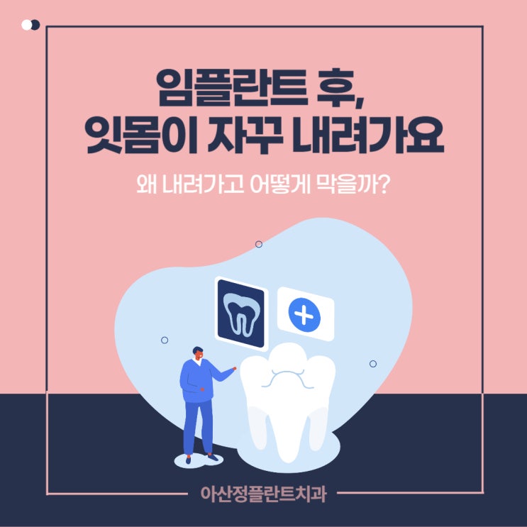  임플란트 후 잇몸이 자꾸 내려가요 – 왜 내려가고 어떻게 막을까?