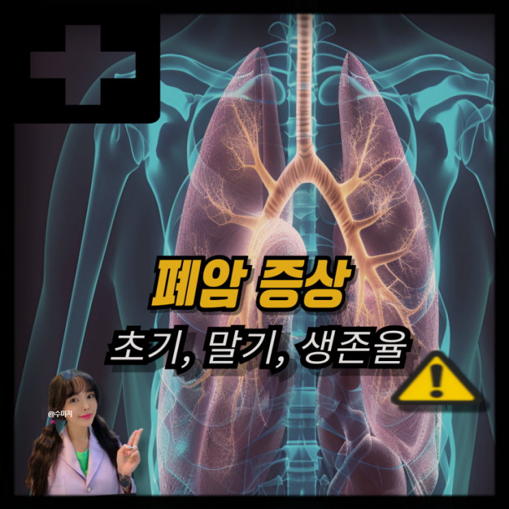  폐암 초기 증상 ~ 폐암 말기 증상 뇌전이 폐암 4기 생존율