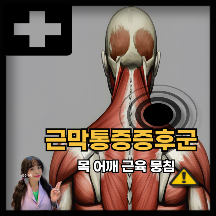  지속되는 어깨 목 통증 원인, 근막통증증후군 증상 치료