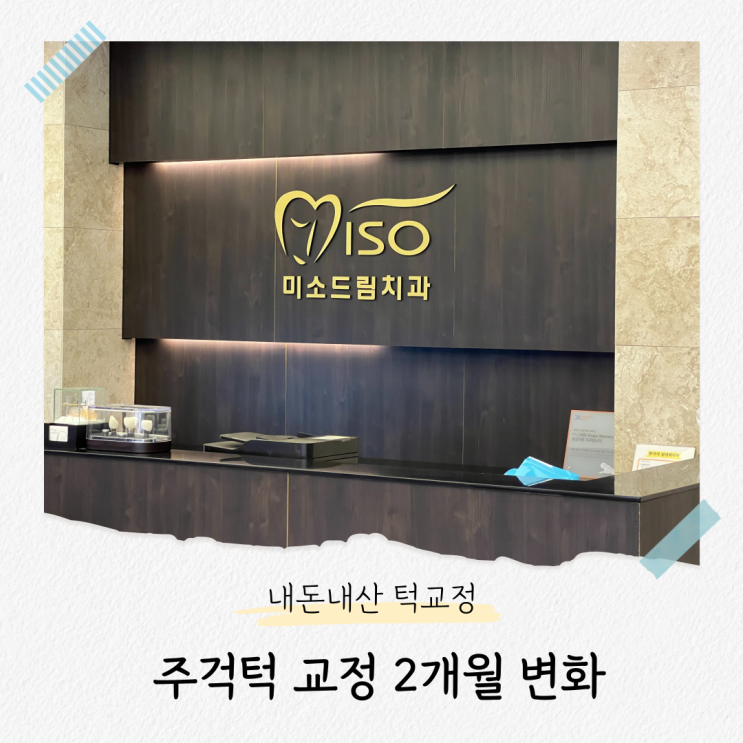  비수술 성인 주걱턱 교정 비용 및 2개월 후 변화