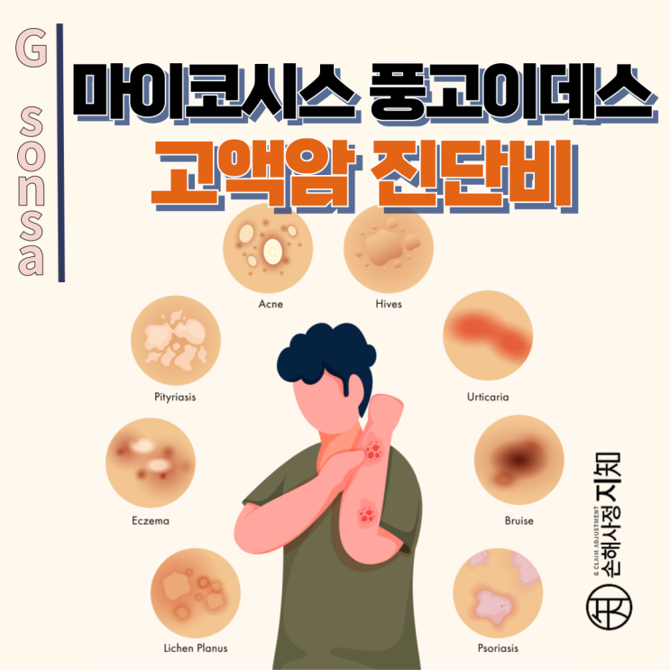  마이코시스 풍고이데스 - 피부암 아닌 림프종, 보험사는 왜 암진단비 거절할까? - [보험금, BA+DA]