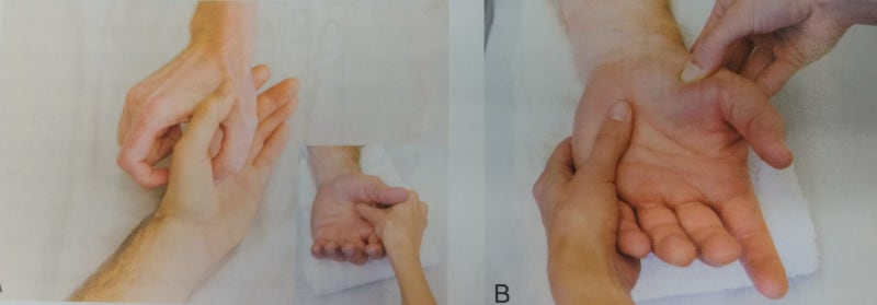 엄지검지 사이통증, 펼때, 잡을때 아파요