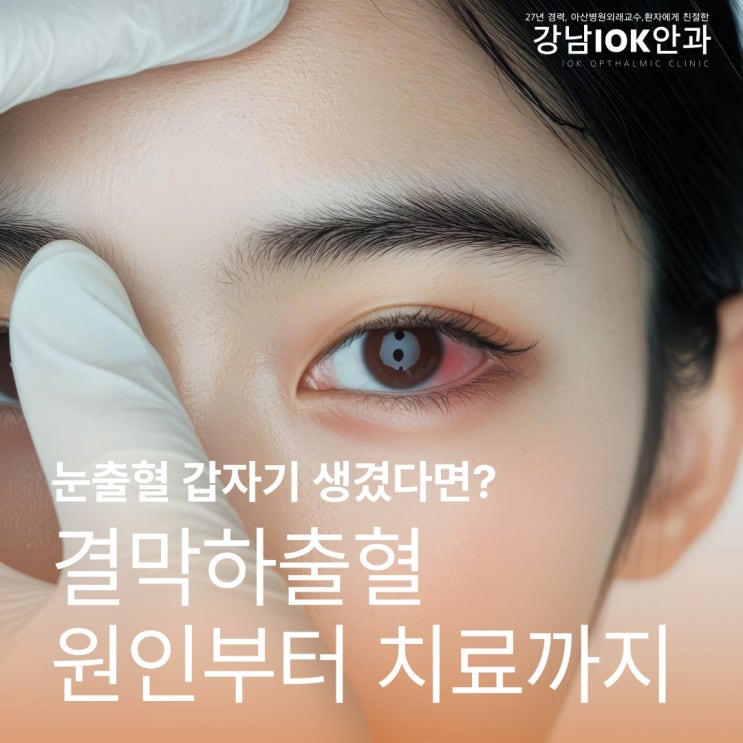  눈출혈 갑자기 생겼다면? 결막하출혈 원인부터 치료까지