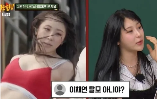 25세 <b>이채연</b>, <b>모발 이식</b> 경험 밝혀 "워터밤 후 탈모 루머 생겨... 