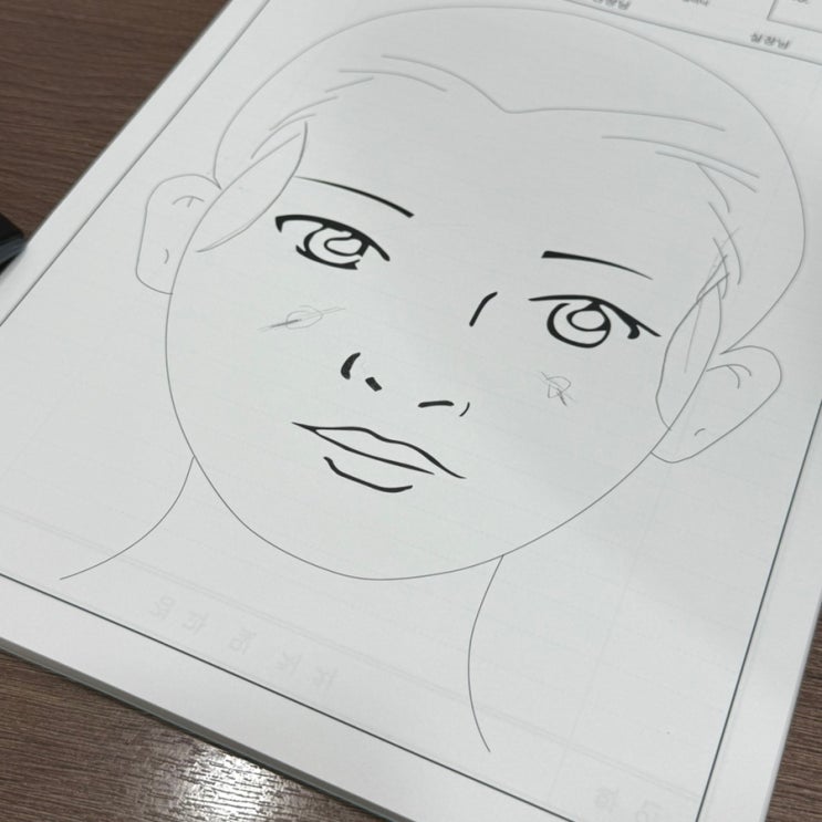 전주 필러 관자놀이, 볼 패임 리비쥬엘 필러 맞고 온 후기