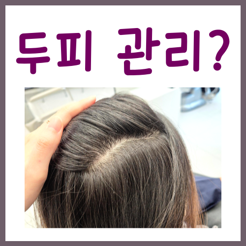  두피관리? 집에서도 쉽게 가능한 방법