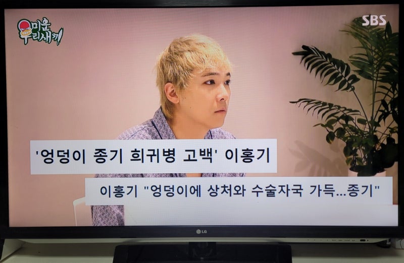 미운우리새끼(미우새), 엉덩이 종기 콤플렉스 이홍기의 반전 매력!