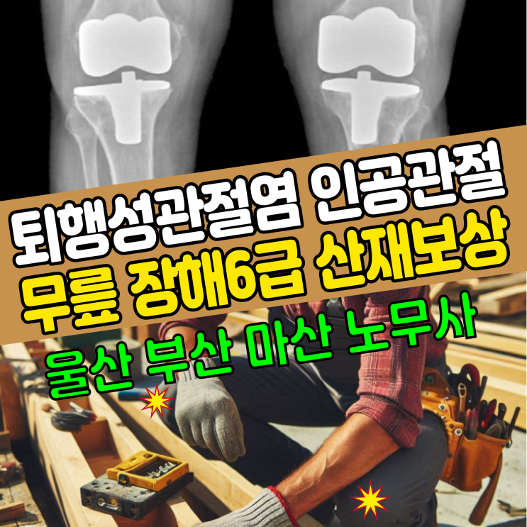 [울산/부산/마산 노무사] 퇴행성관절염 인공관절 무릎 장해6급 산재 보상사례