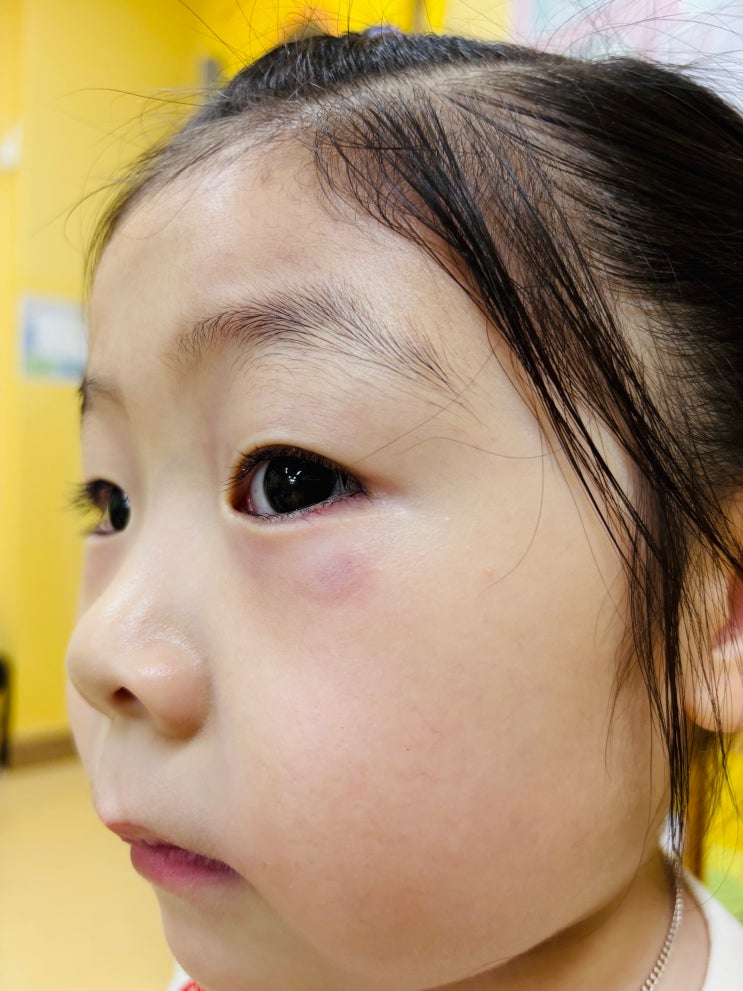  평일 오전 11시, 어린이집으로부터 전화가 울린다