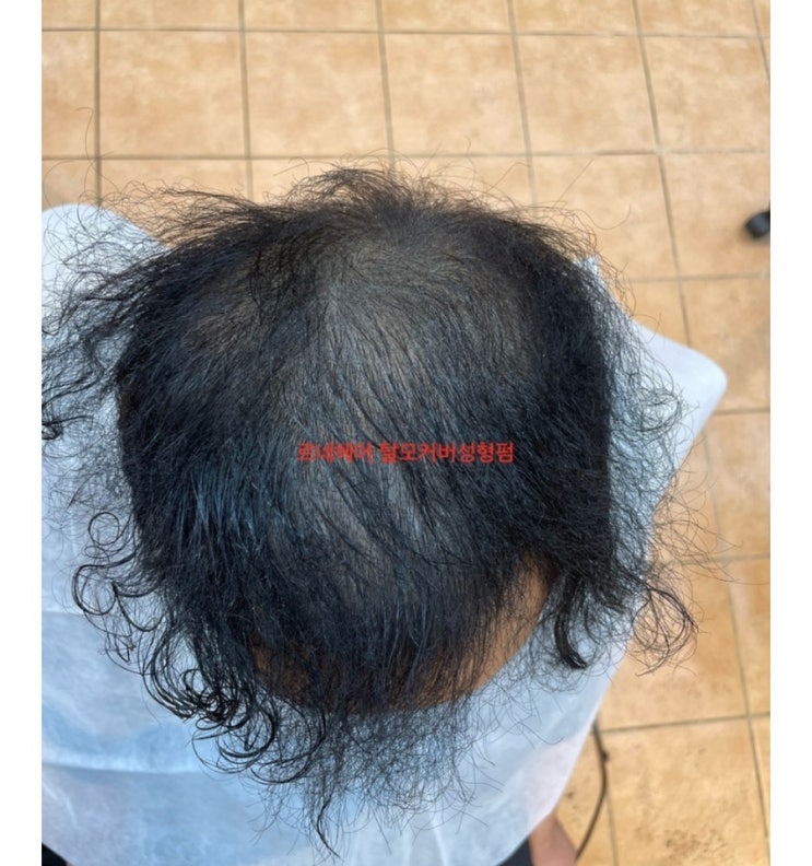  모발ㅇㅅ두피 ㅁㅅ해도휑할때 부산사상르네시떼미용실토탈탈모성형펌으로 숱타일자신감회복 그래서수년째 단골고객이닷!