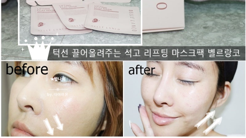 턱선이 예뻐지는 벨르랑코 석고 리프팅 마스크팩 리얼v라인완성